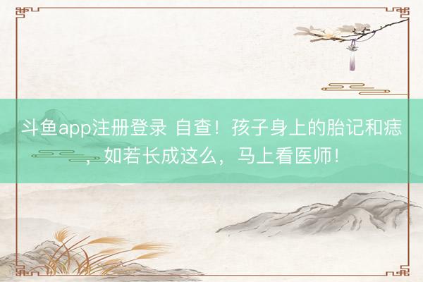 斗鱼app注册登录 自查！孩子身上的胎记和痣，如若长成这么，马上看医师！